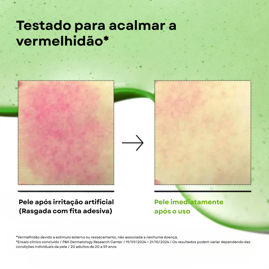 Sérum Calmante com Ácido Azelaico 10% e Ácido Hialurônico