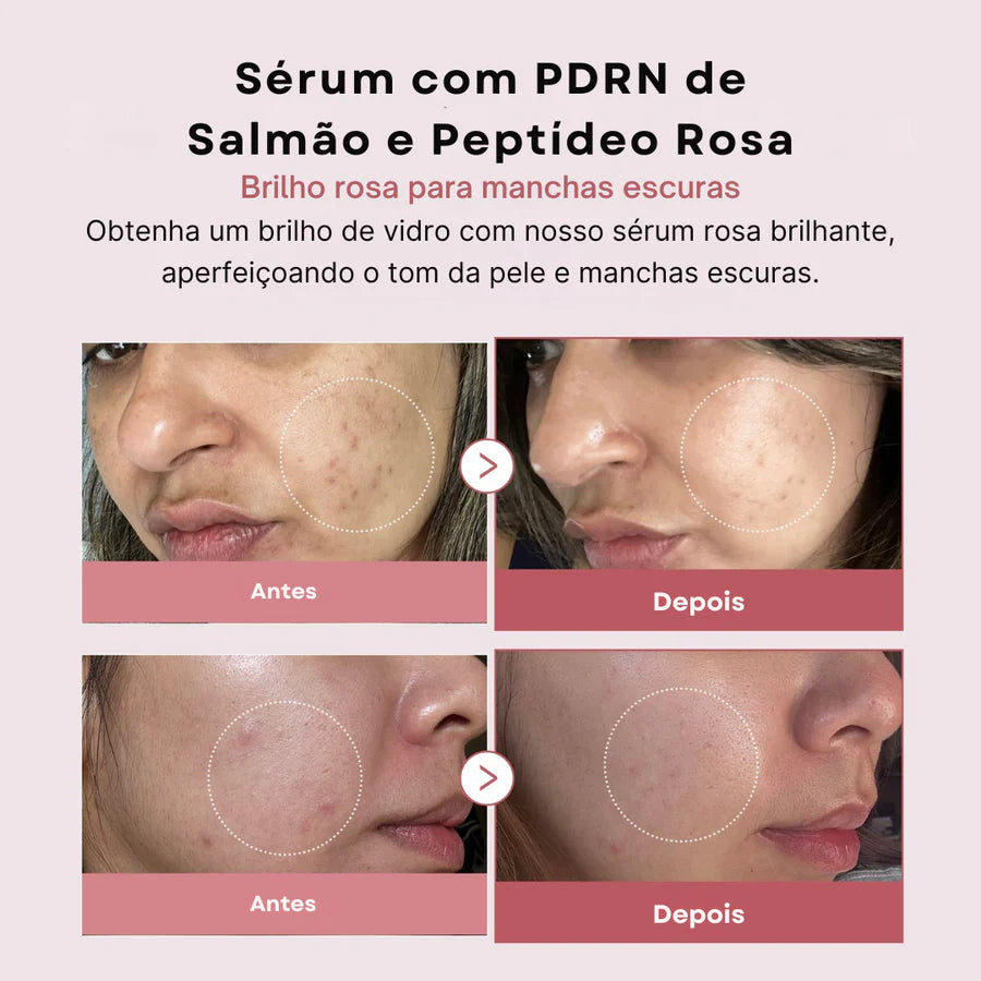 Sérum PDRN de Peptídeos Rosa