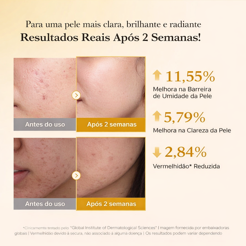 Sérum de Ácido Kójico Cúrcuma e Niacinamida