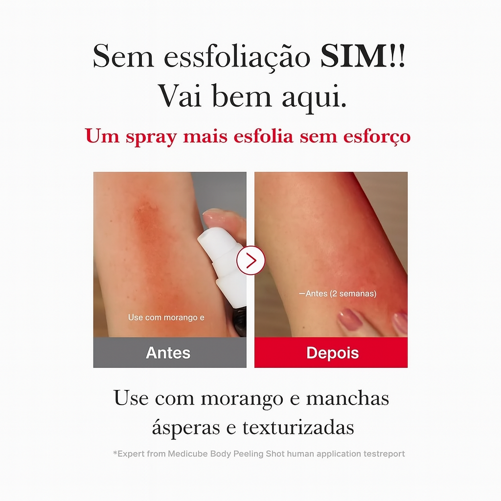 Red Acne Spray Peeling - Esfoliante Corporal