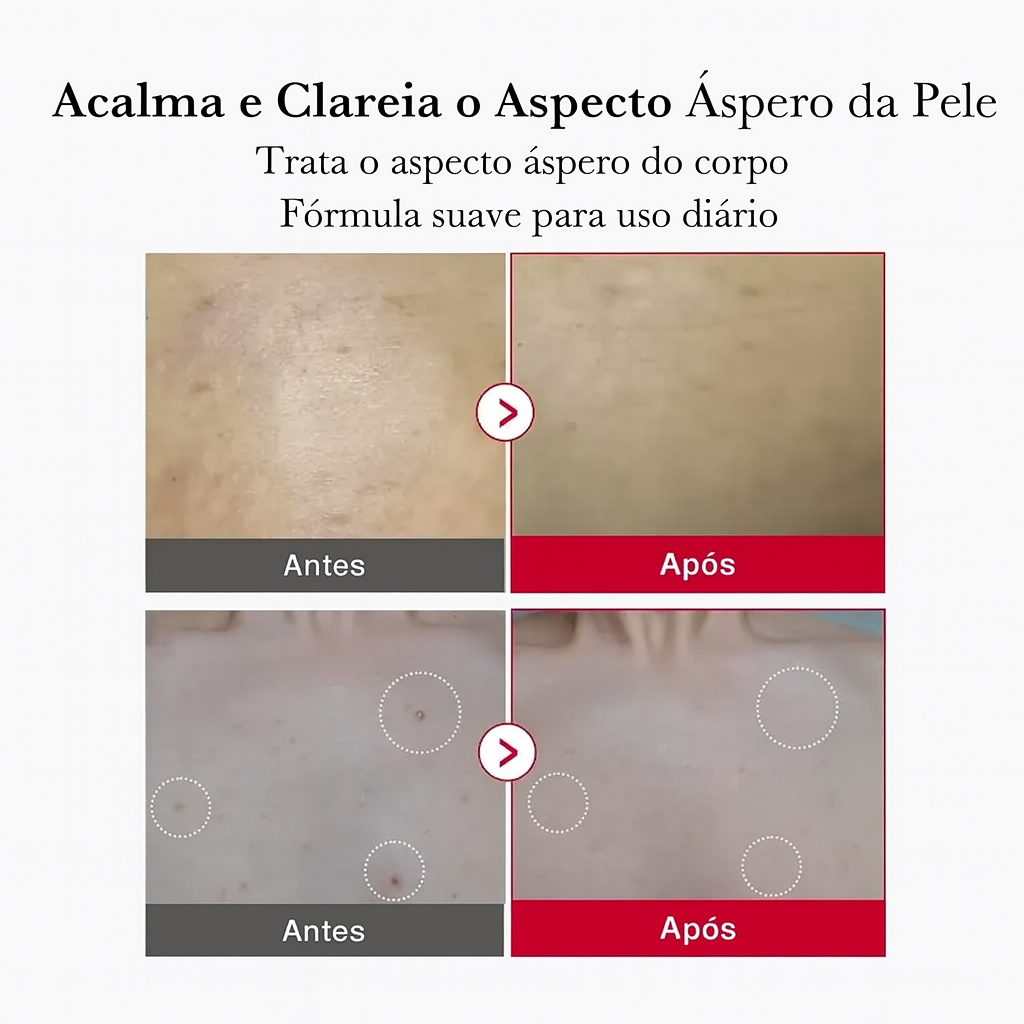 Red Acne Spray Peeling - Esfoliante Corporal